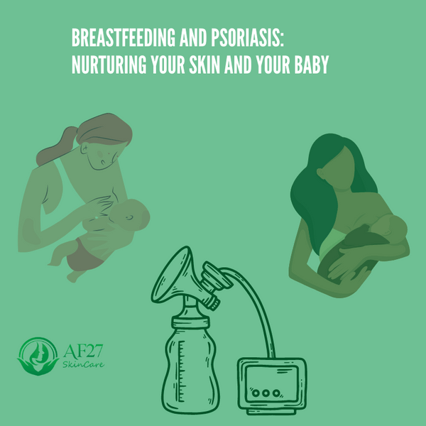Breastfeeding and Psoriasis: Nurturing Your Skin and Your Baby